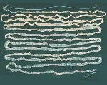 Diphyllobothriasis - okai, tünetei, diagnózisa és kezelése