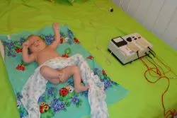 Elektroforézis csecsemők (elektroforézis) Elektroforézis csecsemők
