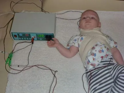 Elektroforézis csecsemők javallatok és ellenjavallatok