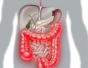 Enterocolitis - tünetek és kezelés a népi jogorvoslati