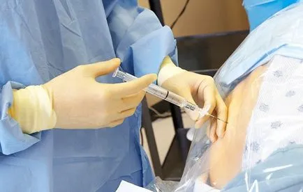 Epidurális érzéstelenítés szülés közben előnyeit, hátrányait, ellenjavallatok, hatások és a szövődmények (profik) Epidurál vajúdás alatt előnyeit, hátrányait, ellenjavallatok, hatásai és szövődményei