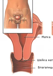 Képek méhnyak erózió (18 fotó) (fotók) Képek méhnyak erózió (18 fotó)