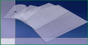 Hernioplasty (sérvműtét) - mi ez, sebészet, árak, videók (linea alba) Hernioplasty (sérvműtét) - mi ez, sebészet, árak, videók