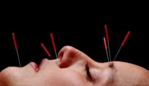 Hyperhydrosis Face Okok és kezelés