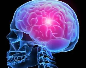 Vérzéses stroke hatások, prognózis, a rehabilitáció, a tünetek (hatások) Vérzéses stroke hatások, prognózis, a rehabilitáció, a tünetek