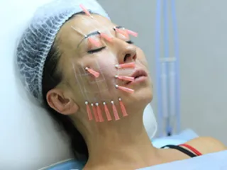 Melyek a szálak egy face-lift, és mennyi fonal van szüksége jellemzői harisnyatartó