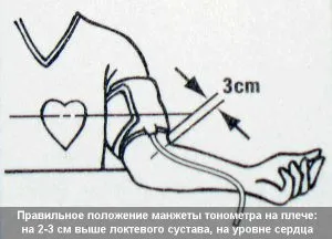 Hogyan mérhető nyomás tonometer kézzel okoz eltérést (mért) Hogyan mérjük a nyomást a kéz tonometer eltérések okait
