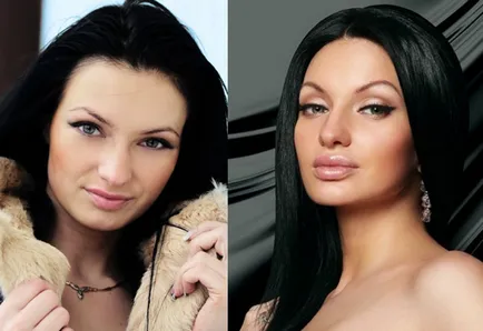 Mivel változatos Evgeny Gusev (Feofilaktova) előtt és után orrplasztika és mammoplasty - 300