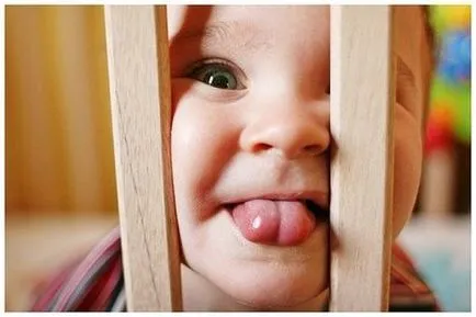 Mivel a szőr segít, hogy a diagnózis (szín) Mivel a szőr segít diagnosztizálni