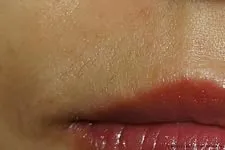 Hogyan, hogy könnyítsen az arc szőrzetének az otthoni egy időben (arc) Hogyan, hogy könnyítsen az arc szőrzetének az otthoni egy időben