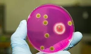 Hogyan kezelésére Staphylococcus aureus