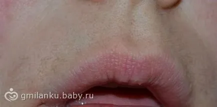 Hogyan, hogy könnyítsen az arc szőrzetének az otthoni egy időben (világosítani arcszőrzet otthon) Hogyan, hogy könnyítsen az arc szőrzetének az otthoni egy időben