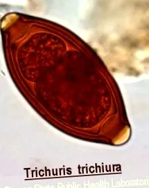 bélparaziták
