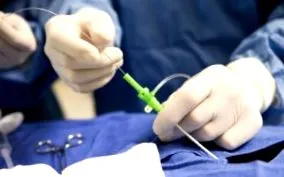 miokardiális rehabilitáció