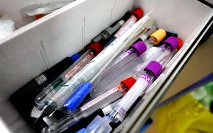immun thrombocytopenic