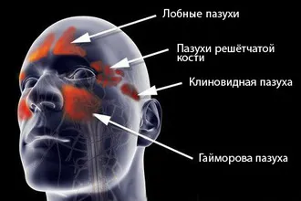 Hogyan tisztítható, héja és öblítsük ki a melléküregek otthon