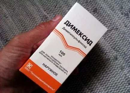 Hogyan lehet eltávolítani a ragasztót ruhákat pillanat