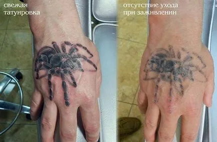 Hogyan törődik a tetoválás cikkek