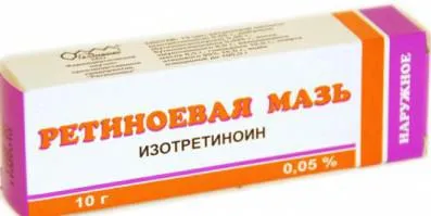 Hogyan lehet megjeleníteni, hogyan lehet megszabadulni a bőr alatti pattanások az arcon