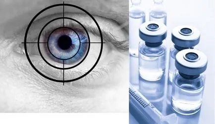 Cataract kezelés népi jogorvoslati az otthoni (népszerűbb) Cataract kezelése népi jogorvoslati otthon