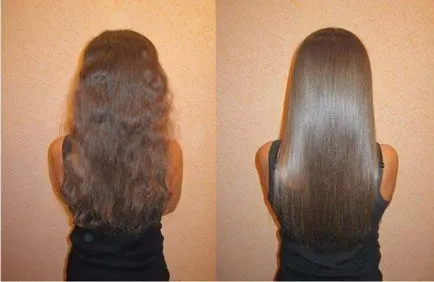 Keratin hajátültetés (vélemény)