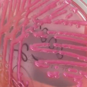 Klebsiella tünetek és Klebsiella pneumonia, Klebsiella egy kenetet, mint a gyógyítás klebsiellu