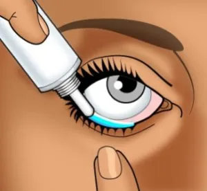 Eye kötőhártyazsákban ahol (fotó) (zsák) Eye kötőhártyazsákban ahol (fotó)