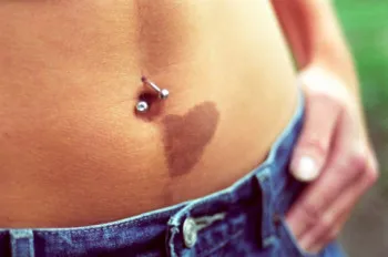 Melanoma kezelése népi jogorvoslati (eszközök) Melanoma kezelése népi jogorvoslati