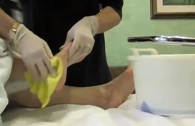 A kezelés a felfekvések ágyhoz kötött idős emberek, hogyan és mit kell eltávolítani