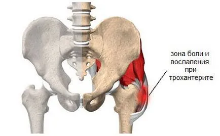 Kezelése hip népi jogorvoslati