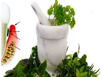 periodontitis kezelése népi jogorvoslat leghatékonyabb módja (a legtöbb) periodontitis kezelése népi jogorvoslat leghatékonyabb módja