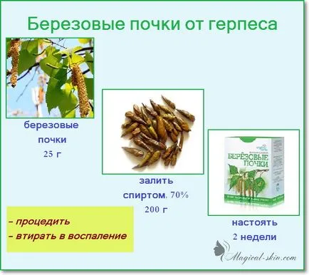 Herpesz otthoni kezelés a népi jogorvoslati (kezelés) Herpesz otthoni kezelés népi jogorvoslati