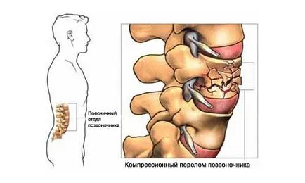Mágneses terápia javallatok és ellenjavallatok, előnyei és hátrányai, otthoni használatra (olvasás) Mágneses terápia javallatok és ellenjavallatok, előnyei és hátrányai, a használata otthon