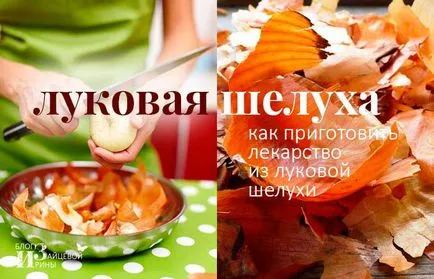 Hagyma héja a népi gyógyászatban (hagyma héja a népi gyógyászatban. Kezelése hagyma bőr) Hagyma héja a népi gyógyászatban