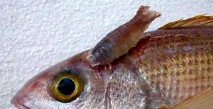 opisthorchiasis opisthorchiasis