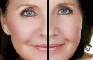 fiatalok hogyan térjen vissza a maszk arc szépsége otthon
