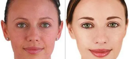 Mezhresnichny tetoválás Eye véleménye, fotók előtt és után