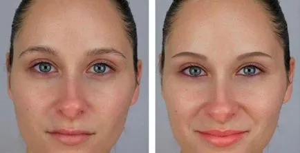 Mezhresnichny tetoválás Eye véleménye, fotók előtt és után