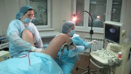 Orvosi abortusz, terhességmegszakítás szövődmények