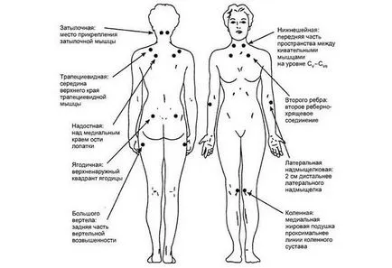 Myalgia - tünetek, kezelés, betegségmegelőzés