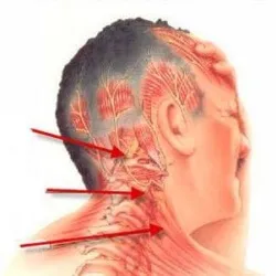 tünetek és kezelések izmos izomtónus (izom) Izmos dystonia tünetek és kezelések