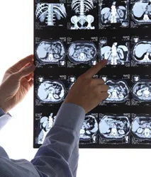 MRI a máj - az ár és a bizonyság az MRI kontraszt a máj (máj) MRI a máj - az ár és a bizonyság az MRI máj kontraszt