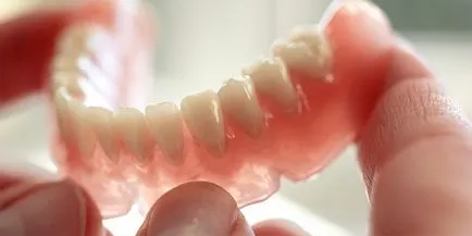 Nylon fogsor fogai részleges és teljes árak és jellemzői (előnyök) Nylon protetikai fogak részleges és teljes jellemzők és az árak