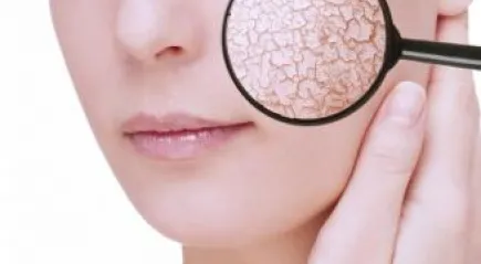 Atópiás dermatitis tünetei és kezelése
