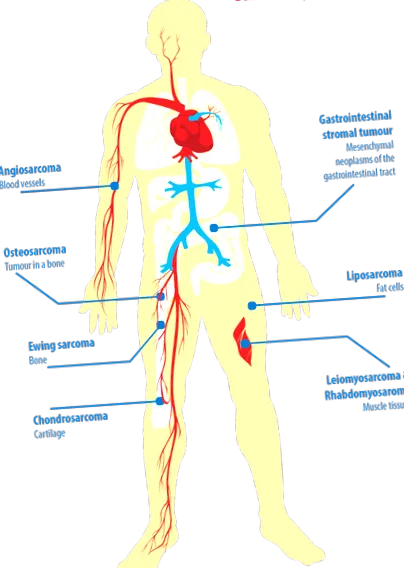 sval