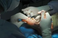 Lapos-valgus deformitás megálló