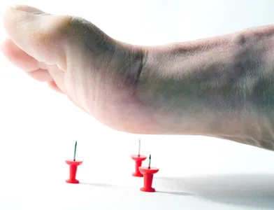 Lapos-valgus deformitás megálló