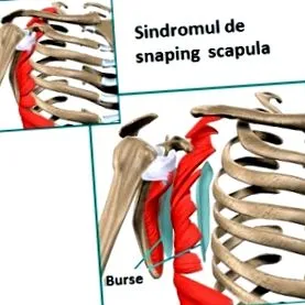 szindróma
