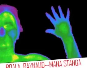 betegség raynaud-szindróma