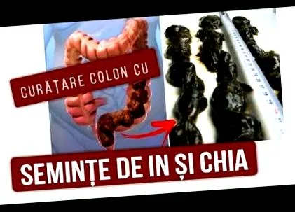 vastagbél